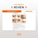 엔브이성형외과의원 | 울산성형외과추천 후기 직접 확인해요