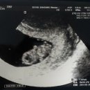 알콩이네 이미지