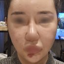바디닥터 당산교육센터 | 올리디아 + 실리프팅 후기, 키닥터가 직접 보여드립니다.