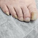 군산시-02741 | 군산 미성동 발톱무좀 깔끔한 케어 후기 골든풋 군산점 비엔네일