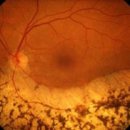 THE(더) 안경원 이미지