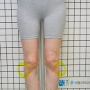 세움보조기 이미지