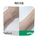 순둥순둥 | 여린피부 학생도 민감부위 어른도 피부에 순둥하게 작용하는 2세대 제모크림 사용후기