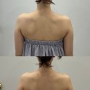 브리앙뜨 에스테틱&아카데미 | 경산 웨딩케어 브리앙뜨에스테틱 승모근 팔뚝관리