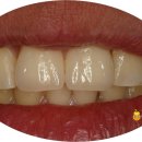 비타민치과기공소 이미지