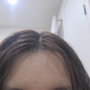 메딕 | 머리빠짐 지성두피관리샴푸로 추천하는 모메딕 샴푸후기