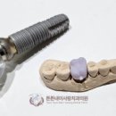 튼튼내이사랑치과의원 이미지