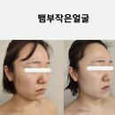 피오레 | 대구얼굴경락 뱀부관리 피오레에스테틱 후기