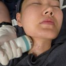 플레저성형외과의원 | ✨ 신논현역성형외과 플레저성형외과 이중턱 온다리프팅 + 지방분해주사 솔직후기 (붓기, 효과 정리)