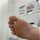 써비네일 | 동탄 정자동 발각질 유해균 각질관리 후기 무드비네일 페디크루 화성동탄점