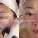 미를 그리다 피부관리 대구 본점 | 대구 수성구 리프팅관리 전문 에스테틱 골든w스킨앤왁싱 범어점 솔직후기