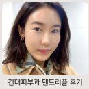 트리플 | 처진 피부 살려준 건대피부과 텐트리플 리프팅초음파 후기