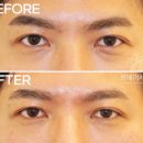 르에이치의원 이미지