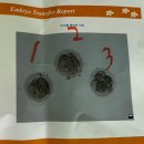 서초중앙로8길 16 | 2506 서초 함춘 시험관 신선1차 - 채취,3일배양신선이식