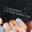 강자안손톱 이미지