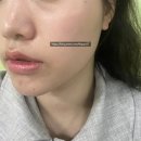 고은가든 | [왕십리 에스테틱] 결이고은 피부관리 추천지점, 결이고은 왕십리점