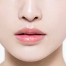 포레시스