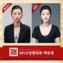 윤곽성형외과의원 이미지