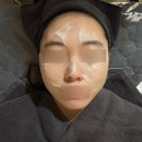 에이블케어 | [용인 에스테틱] 에이블메디스킨 용인보정점 미백이온자임케어 및 목주름관리 내돈내산 후기