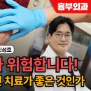 신성호심장혈관흉부외과 비온뒤