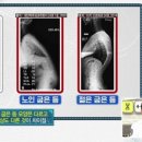 초등 필라테스 이미지