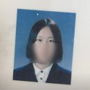 비아이오 | 쌍꺼풀 3번째 재수술 후기 + 6년 경과 후기 (비아이오 성형외과)