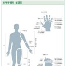 손가락의 장해[(무) e로운 뇌혈관질환보장보험(해약환급금 미지급형)(2501)] 이미지