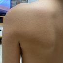 히알루론산 보습템, 아토바이탈 사용후기!! 이미지