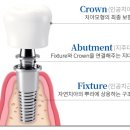 인덕원치과의원 | 인덕원임플란트 치과 추천 TOP2 틀니 비교 후기