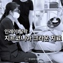푸른부부치과의원 | 치료 증포동 인레이탈락 2차 충치 해결, 신경 살리는 지르코니아 크라운 치료 후기 (이천 연세부부 치과)