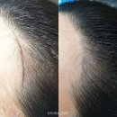 곱슬머리헤어라인