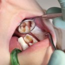 중앙치과 이미지