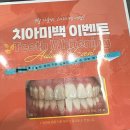 강남 치과는 이곳!! 치아미백 + 스케일링 받고왔어요~ 가격착하고 시설좋은 치과 진심후기! 전후효과