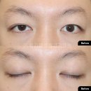 뷰라밸성형외과의원 이미지