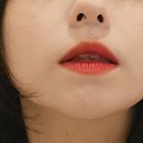 [올리지오 리프팅 300샷 내돈내산 후기]가격, 효과, 부작용, 유지기간, 주기, 통증! 강남 W클리닉