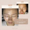 브리엘왁싱 | 보정동왁싱/ 풀페이스 왁싱 후기/브리엘 왁싱샵 후기