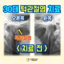 성모척바른의원 | 턱관절 치료 실비보험, 턱관절염 비용 및 후기 <전문의 작성>