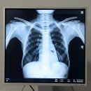 언택트마트 | 으악, 내 어깨 돌리도! 수원에서 정형외과 찾을 때 찐텐 후기 갑니다