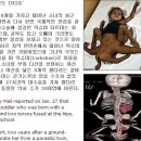 카페에 teratoma 소개된 글에서 등장했던(?) 소녀의 근황이라고 합니다^^ 이미지