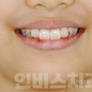 인비스치과의원 이미지