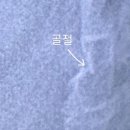 (주)지온약품 | 엉덩방아 천골 골절 통원치료 회복일기 골절에 좋은 약품 추천 보험청구 금융치료