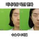 로이성형외과의원 이미지