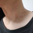 요대로 | 임신중기 일기(임신18주~27주) - 정밀초음파, 임당검사, 입체초음파, 서울시 임산부 교통비 지원