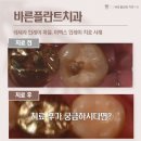 바를정치과의원 네이버블로그