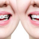 휴플란트치과의원 이미지