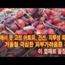 병원에서 못 고친 아토피, 건선 , 지루성 피부병과 겨울철 극심한 피부가려움증 까지 이 열매 하나면 끝장 이미지