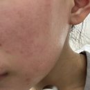 쿼드쎄라 미니튠 솔직 후기, 요즘 매일 쓰는 뷰티디바이스