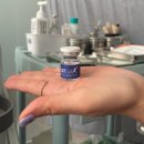 1회 사진기록전 | 창원 시티세븐 피부과 흑자 제거 2회차 후기 ( + 전후사진, 딱지, 통증 기록 )