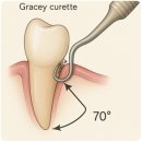 수성아이비치과의원 | 🦷 마지막 잇몸 치료 완료! 대구 수성아이비치과에서의 4회차 치료 후기
