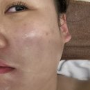 평율 | 부평 에스테틱 유리햅에스떼 윤곽관리후기 도수관리